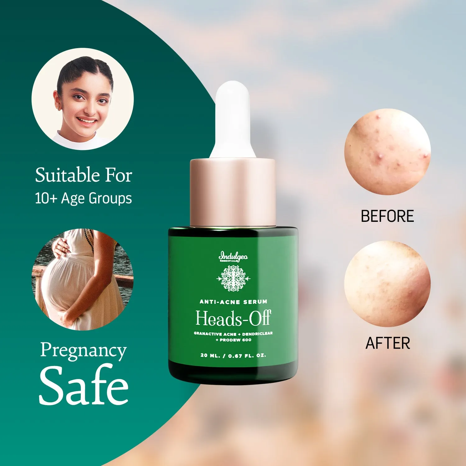 Heads Off - Anti Acne Serum