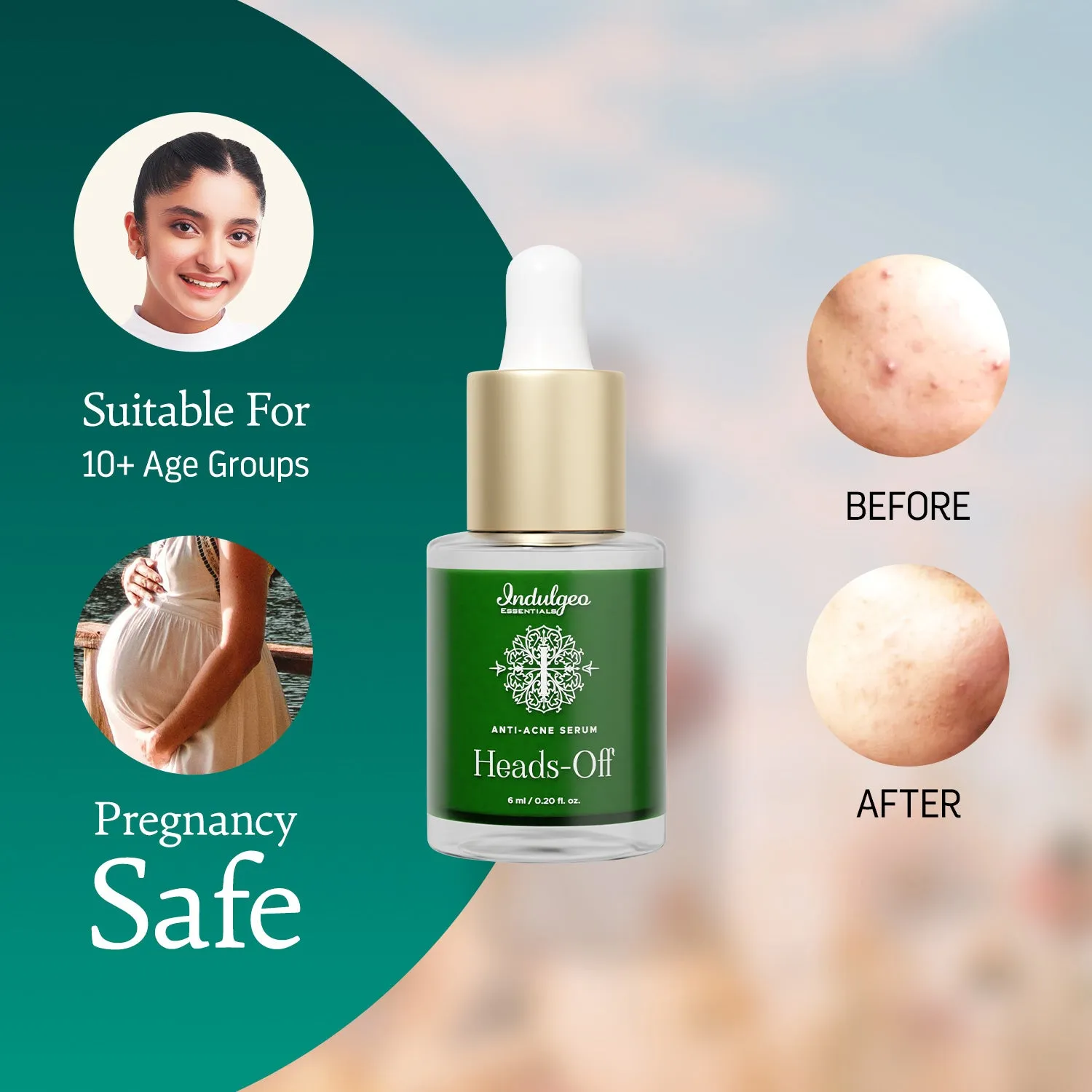 Mini Heads Off - Anti Acne Serum - 6mL